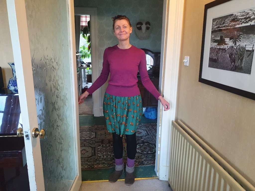 Me wearing a green skirt with foxes on it.