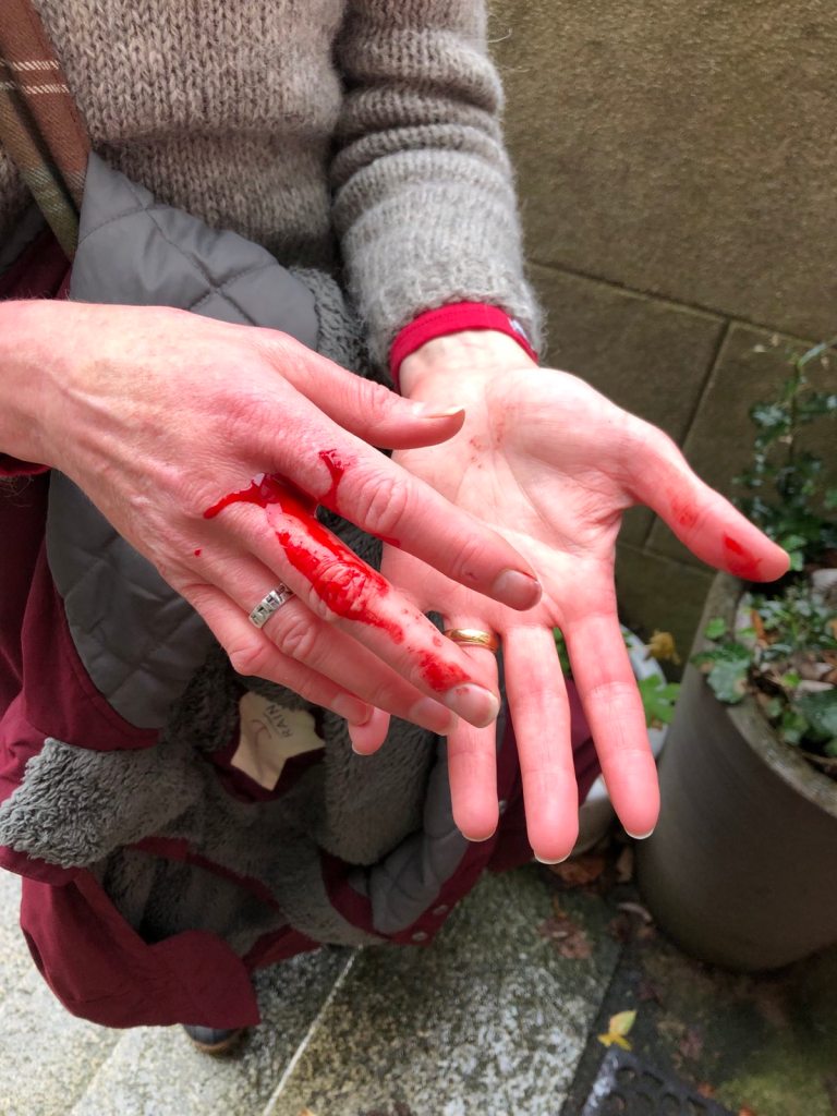 Blood running down my fingers.
