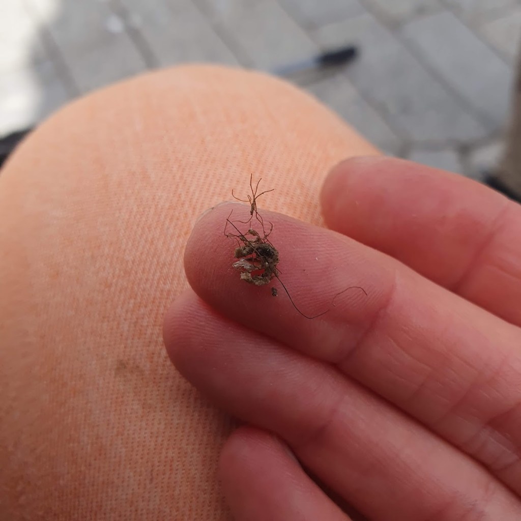 The hair we removed from the pigeon