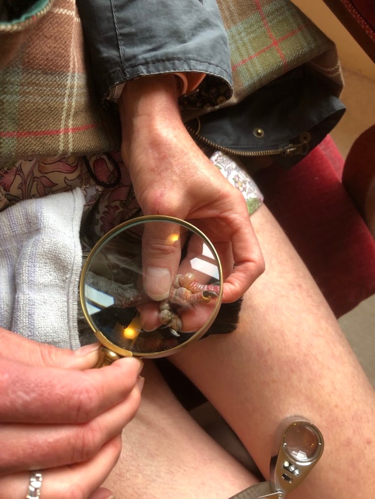 A close-up of her feet under the magnifying glass