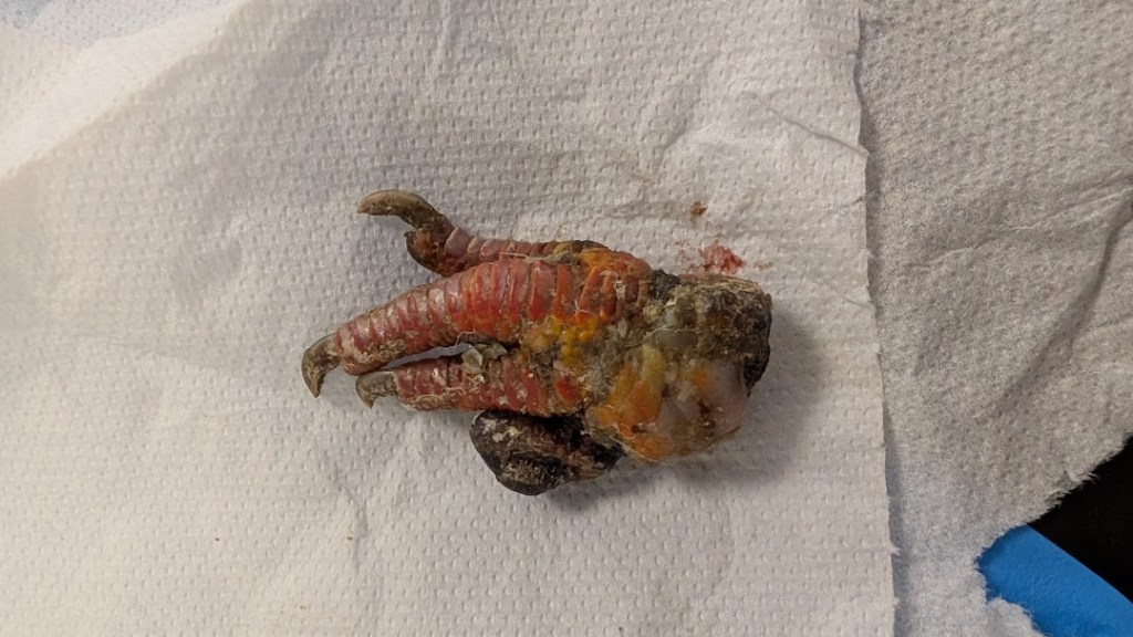The foot just after removal. It's very swollen, looks infected and one toe is black.